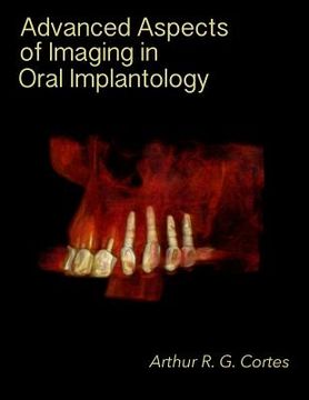 portada Advanced Aspects of Imaging in Oral Implantology (en Inglés)