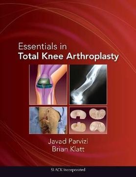 essentials in total knee arthroplasty