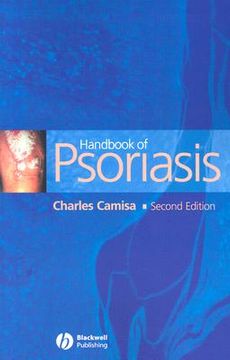 portada Handbook of Psoriasis (en Inglés)