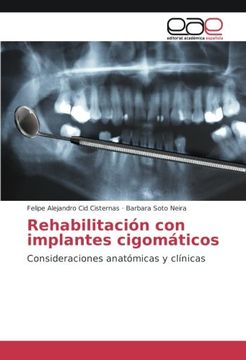 portada Rehabilitación con implantes cigomáticos: Consideraciones anatómicas y clínicas (Spanish Edition)