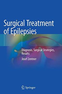 portada Surgical Treatment of Epilepsies: Diagnosis, Surgical Strategies, Results 