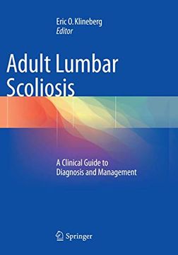 portada Adult Lumbar Scoliosis: A Clinical Guide to Diagnosis and Management