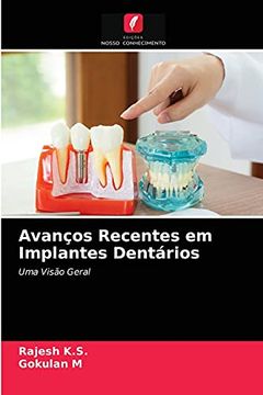 portada Avanços Recentes em Implantes Dentários: Uma Visão Geral (en Portugués)