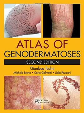 portada Atlas of Genodermatoses (in English)