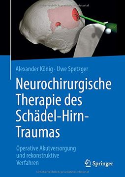 portada Neurochirurgische Therapie des Schädel-Hirn-Traumas: Operative Akutversorgung und Rekonstruktive Verfahren (in German)