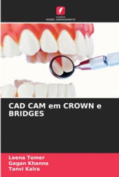 portada Cad cam em Crown e Bridges (en Portugués)