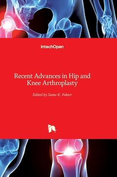 portada Recent Advances in Hip and Knee Arthroplasty