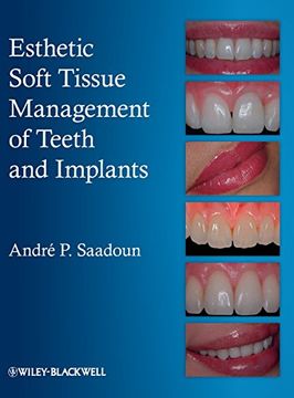 portada esthetic soft tissue management of teeth and implants