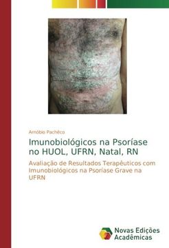 portada Imunobiológicos na Psoríase no HUOL, UFRN, Natal, RN: Avaliação de Resultados Terapêuticos com Imunobiológicos na Psoríase Grave na UFRN