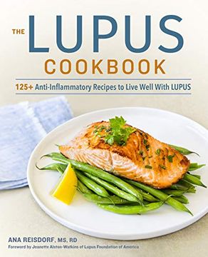 portada The Lupus Cookbook: 125+ Anti-Inflammatory Recipes to Live Well With Lupus (en Inglés)