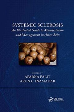 portada Systemic Sclerosis: An Illustrated Guide to Manifestation and Management in Asian Skin (en Inglés)