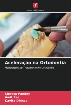 portada Aceleração na Ortodontia: Modalidades de Tratamento em Ortodontia (en Portugués)