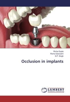 portada Occlusion in implants