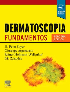 portada Dermatoscopia: Fundamentos (in Spanish)