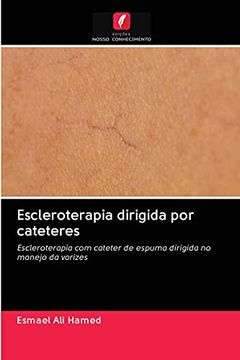 portada Escleroterapia Dirigida por Cateteres: Escleroterapia com Cateter de Espuma Dirigida no Manejo da Varizes (in Portuguese)