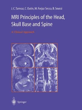 portada MRI Principles of the Head, Skull Base and Spine: A Clinical Approach