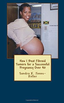 portada How I Beat Fibroid Tumors for a Successful Pregnancy Over 40