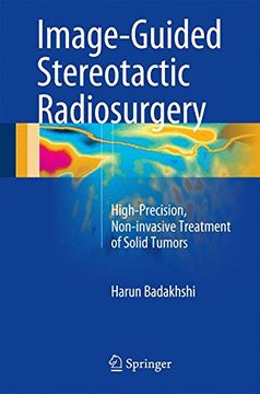 portada Image-Guided Stereotactic Radiosurgery: High-Precision, Non-invasive Treatment of Solid Tumors
