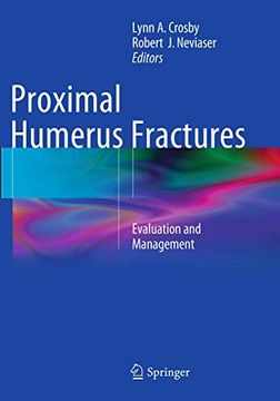 portada Proximal Humerus Fractures: Evaluation and Management (en Inglés)