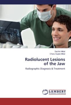 portada Radiolucent Lesions  of the Jaw: Radiographic Diagnosis & Treatment