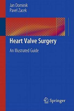 portada heart valve surgery (en Inglés)