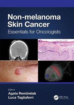 portada Non-Melanoma Skin Cancer: Essentials for Oncologists (Series in Medical Physics and Biomedical Engineering) 