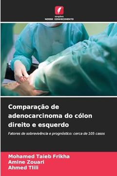 portada Comparação de Adenocarcinoma do Cólon Direito e Esquerdo (in Portuguese)