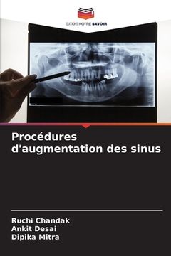 portada Procédures d'augmentation des sinus (en Francés)