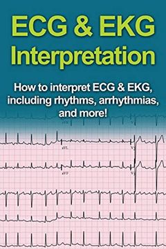 portada Ecg & ekg Interpretation: How to Interpret ecg & Ekg, Including Rhythms, Arrhythmias, and More! (en Inglés)