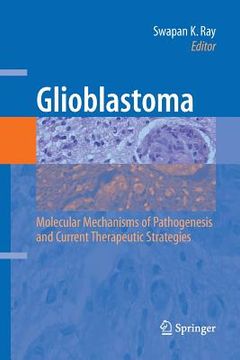 portada Glioblastoma:: Molecular Mechanisms of Pathogenesis and Current Therapeutic Strategies (in English)