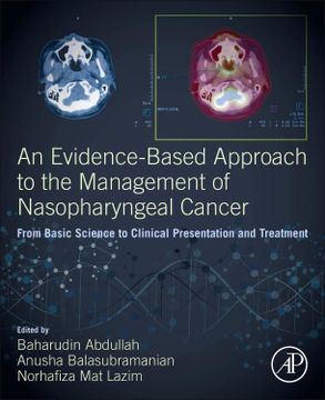 portada An Evidence-Based Approach to the Management of Nasopharyngeal Cancer: From Basic Science to Clinical Presentation and Treatment (en Inglés)