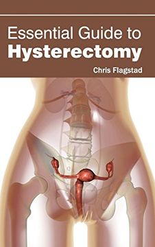 portada Essential Guide to Hysterectomy (en Inglés)