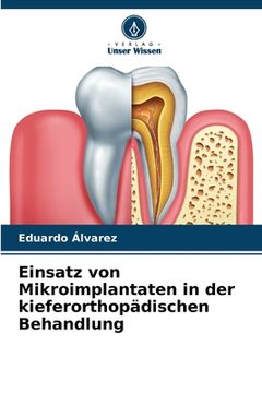 portada Einsatz von Mikroimplantaten in der kieferorthopädischen Behandlung (en Alemán)