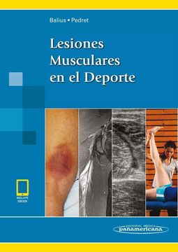 portada Lesiones Musculares en el Deporte (Incluye ) (in Spanish)