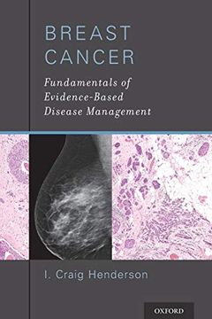 portada Breast Cancer: Fundamentals of Evidence-Based Disease Management (en Inglés)