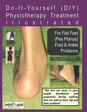 portada Physiotherapy Treatment Illustrated for Flat Feet (Pes Planus) Foot & Ankle Problems: 1 (Iriz_Self_Help) (en Inglés)