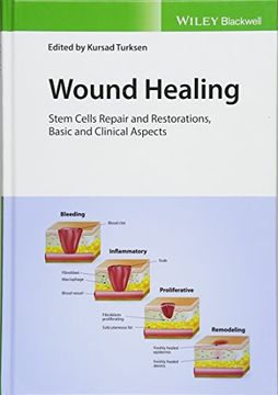 portada Wound Healing: Stem Cells Repair and Restorations, Basic and Clinical Aspects