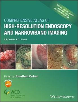 Comprehensive Atlas of High-Resolution Endoscopy and Narrowband Imaging (en Inglés)