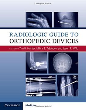 portada Radiologic Guide to Orthopedic Devices 