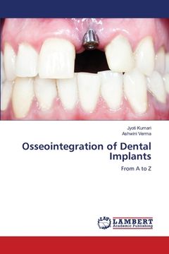portada Osseointegration of Dental Implants (en Inglés)