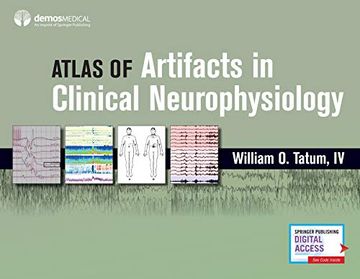 portada Atlas of Artifacts in Clinical Neurophysiology (en Inglés)