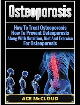 portada Osteoporosis: How To Treat Osteoporosis: How To Prevent Osteoporosis: Along With Nutrition, Diet And Exercise For Osteoporosis (Reverse or Prevent Bone Loss From Osteoporosis All) (in English)