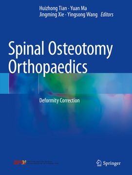 Spinal Osteotomy Orthopaedics: Deformity Correction (en Inglés)