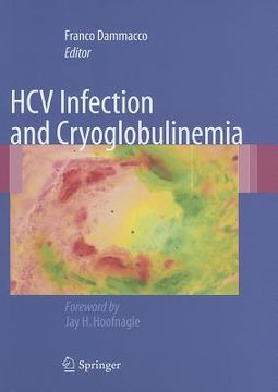 portada HCV Infection and Cryoglobulinemia (in English)