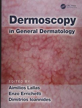 portada Dermoscopy in General Dermatology (en Inglés)