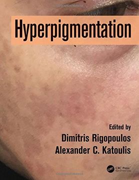 portada Hyperpigmentation