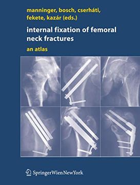 portada Internal Fixation of Femoral Neck Fractures: An Atlas (en Inglés)