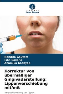 portada Korrektur von übermäßiger Gingivadarstellung: Lippenverschiebung mit/mit (en Alemán)