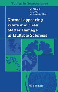 portada Normal-Appearing White and Grey Matter Damage in Multiple Sclerosis (en Inglés)
