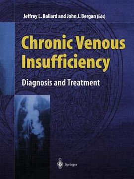 portada Chronic Venous Insufficiency: Diagnosis and Treatment (en Inglés)